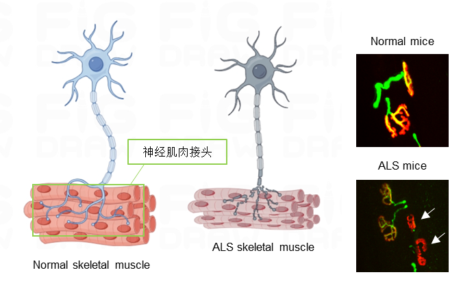 生命学院李磊课题组发现渐冻症抗体治疗的新手段