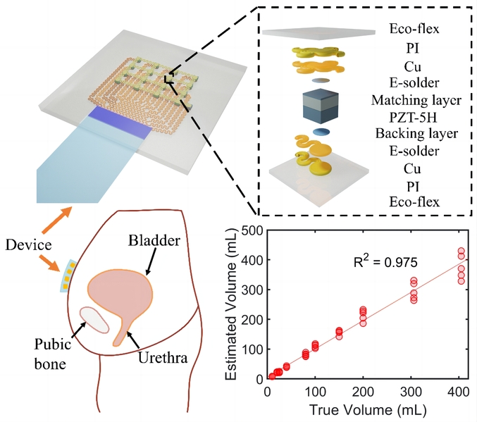 生医工学院彭畅课题组研发一种用于膀胱容积连续监测的柔性可穿戴超声器件